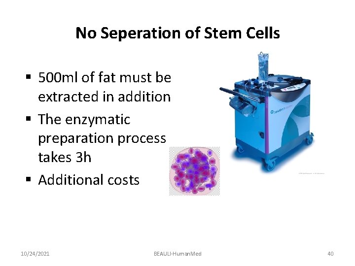 No Seperation of Stem Cells § 500 ml of fat must be extracted in