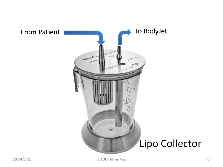 to Body. Jet From Patient Lipo Collector 10/24/2021 BEAULI-Human. Med 42 