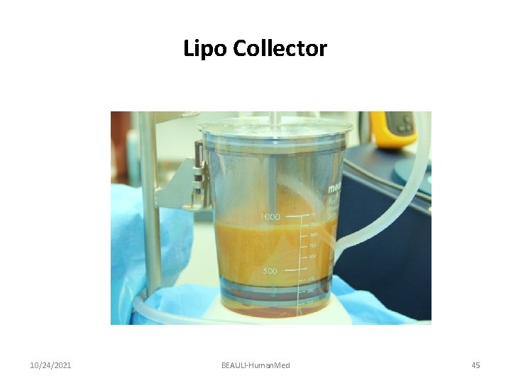 Lipo Collector 10/24/2021 BEAULI-Human. Med 45 