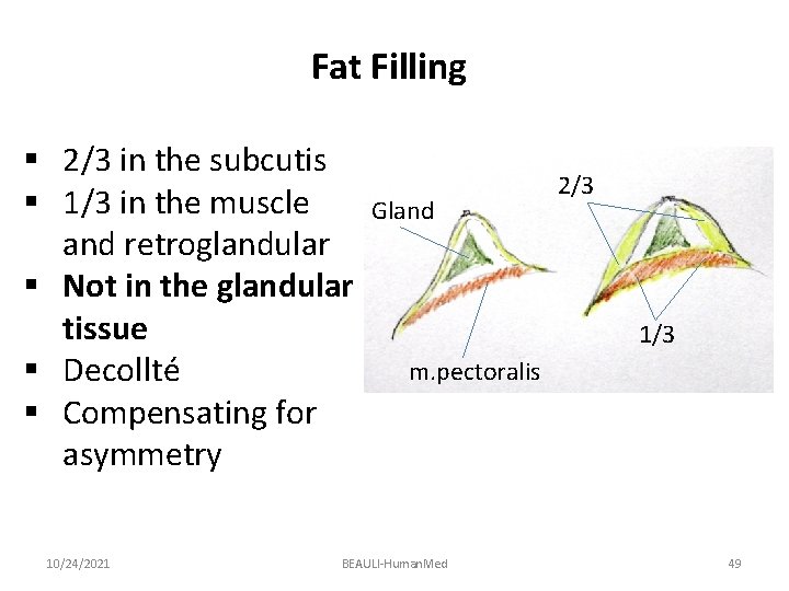 Fat Filling § 2/3 in the subcutis § 1/3 in the muscle and retroglandular
