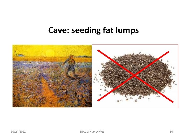 Cave: seeding fat lumps 10/24/2021 BEAULI-Human. Med 50 