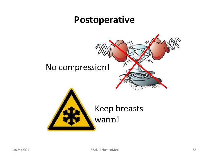 Postoperative No compression! Keep breasts warm! 10/24/2021 BEAULI-Human. Med 55 