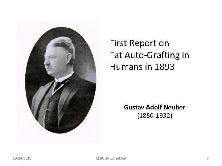 First Report on Fat Auto-Grafting in Humans in 1893 Gustav Adolf Neuber (1850 -1932)