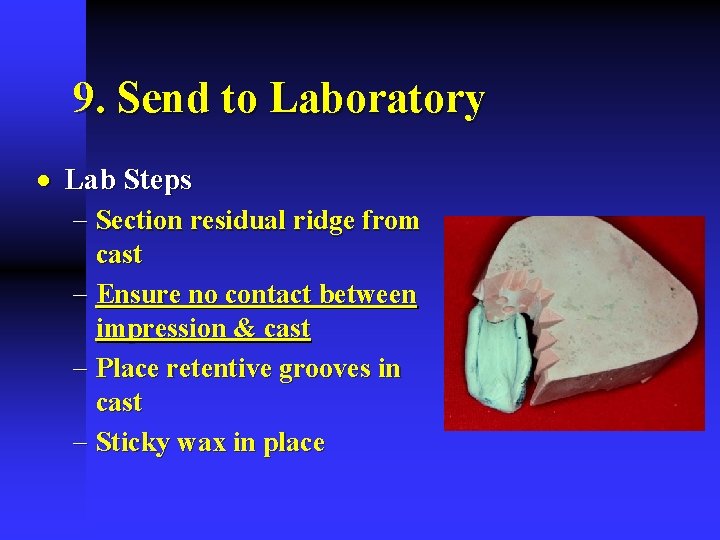 9. Send to Laboratory · Lab Steps - Section residual ridge from cast -