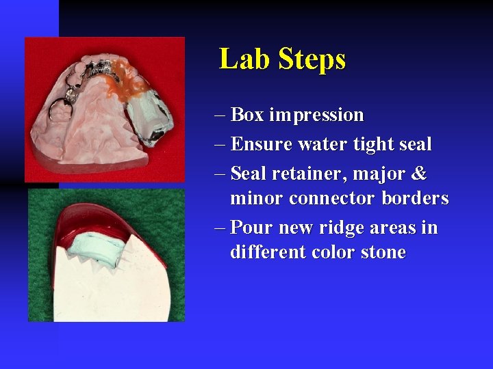 Lab Steps - Box impression - Ensure water tight seal - Seal retainer, major