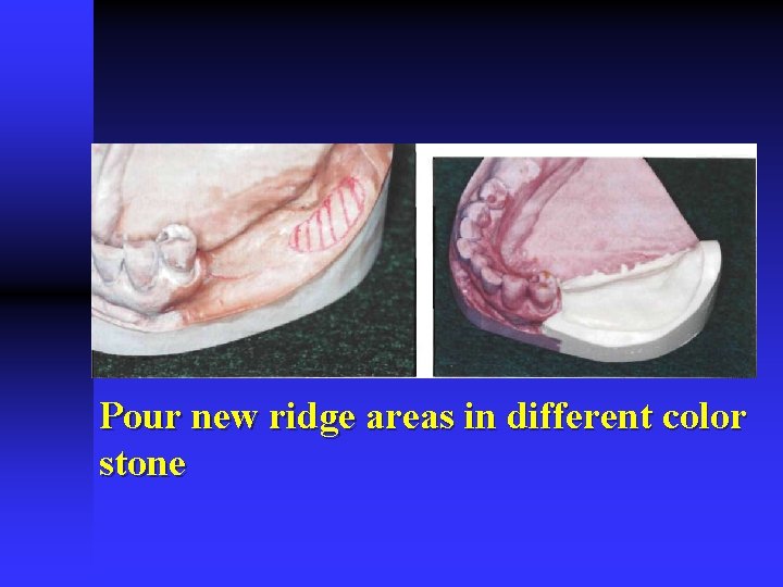 Pour new ridge areas in different color stone 