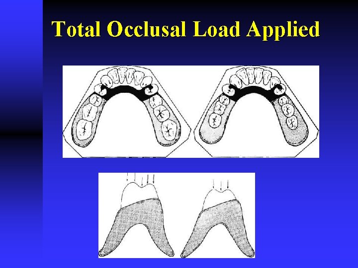 Total Occlusal Load Applied 