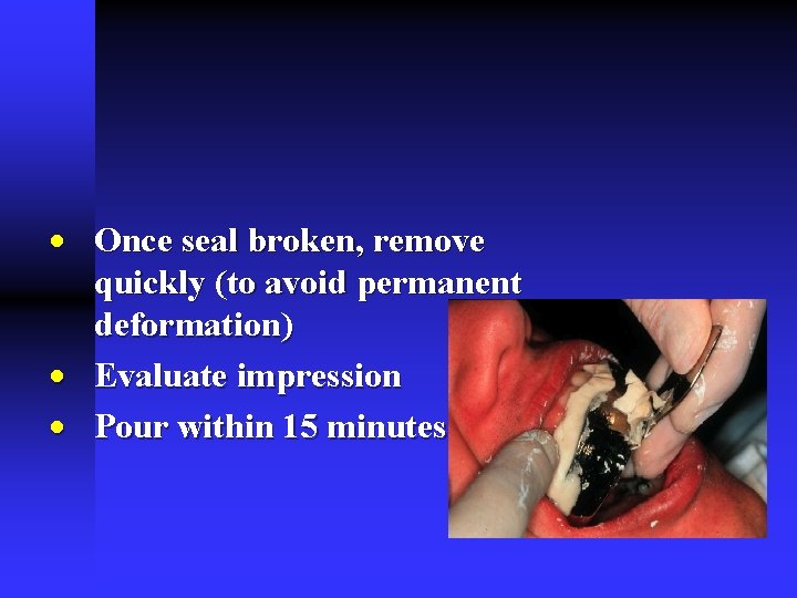 · Once seal broken, remove quickly (to avoid permanent deformation) · Evaluate impression ·