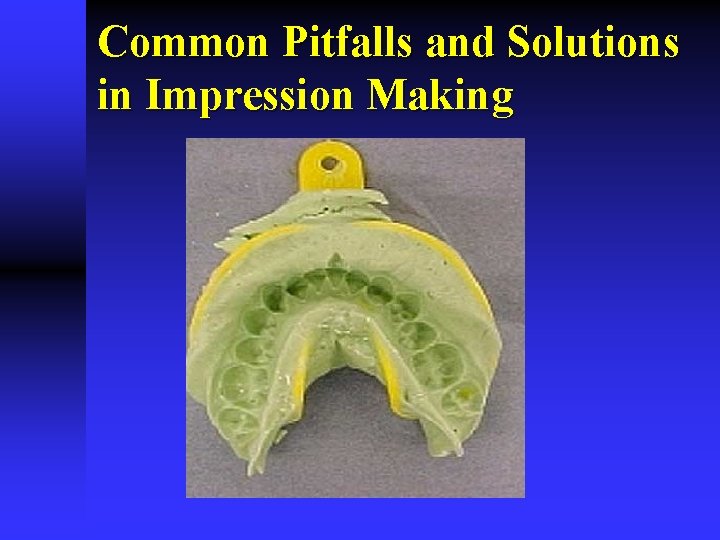 Common Pitfalls and Solutions in Impression Making 