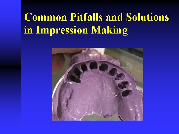 Common Pitfalls and Solutions in Impression Making 