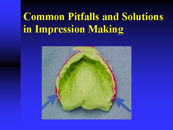 Common Pitfalls and Solutions in Impression Making 