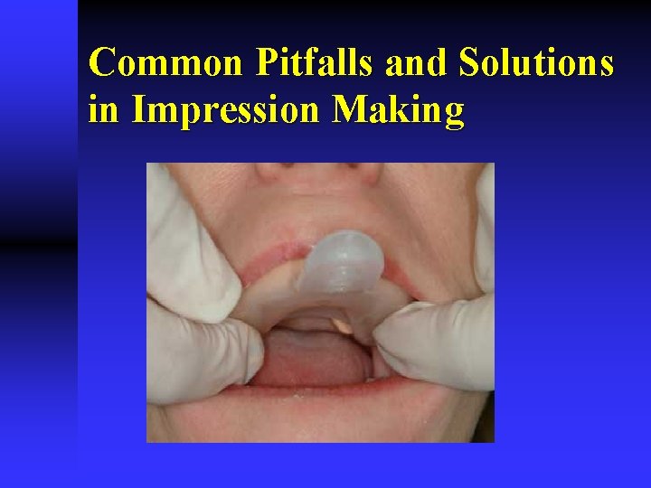 Common Pitfalls and Solutions in Impression Making 
