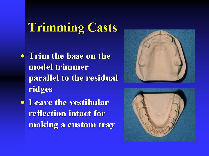Trimming Casts · Trim the base on the model trimmer parallel to the residual
