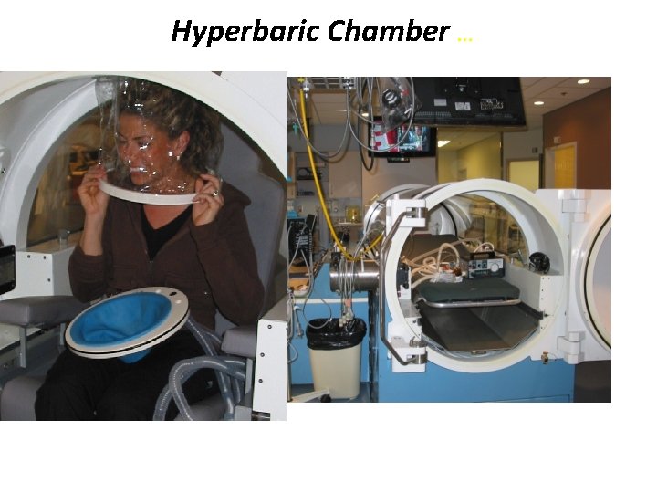 Hyperbaric Chamber … 