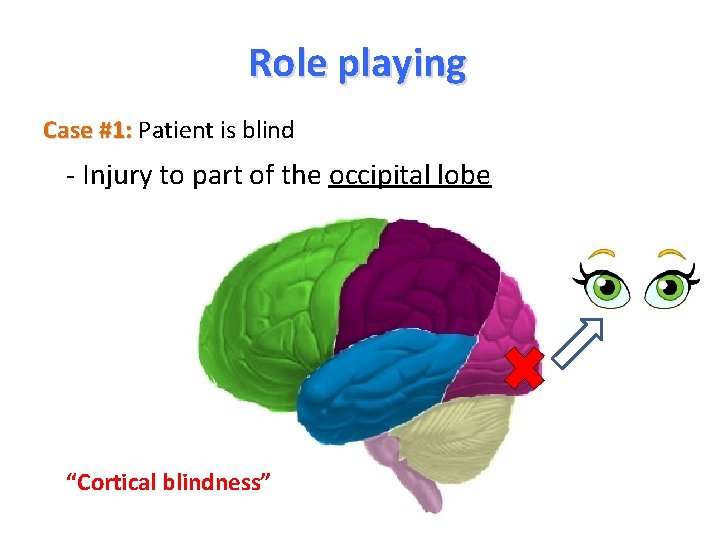 Role playing Case #1: Patient is blind - Injury to part of the occipital