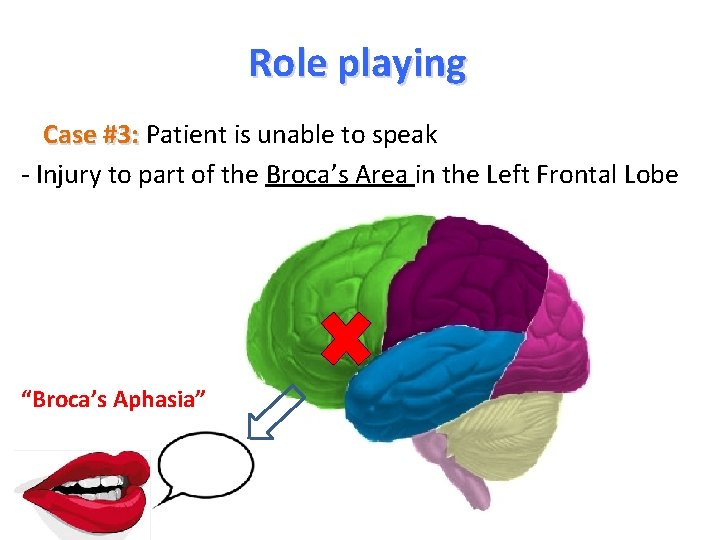 Role playing Case #3: Patient is unable to speak - Injury to part of
