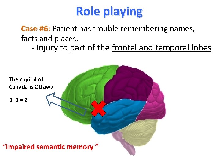 Role playing Case #6: Patient has trouble remembering names, facts and places. - Injury