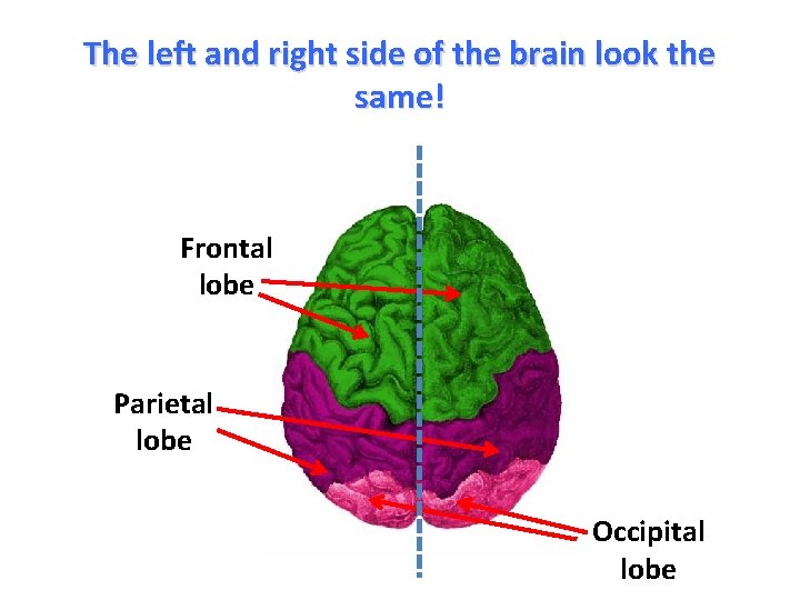 The left and right side of the brain look the same! Frontal lobe Parietal