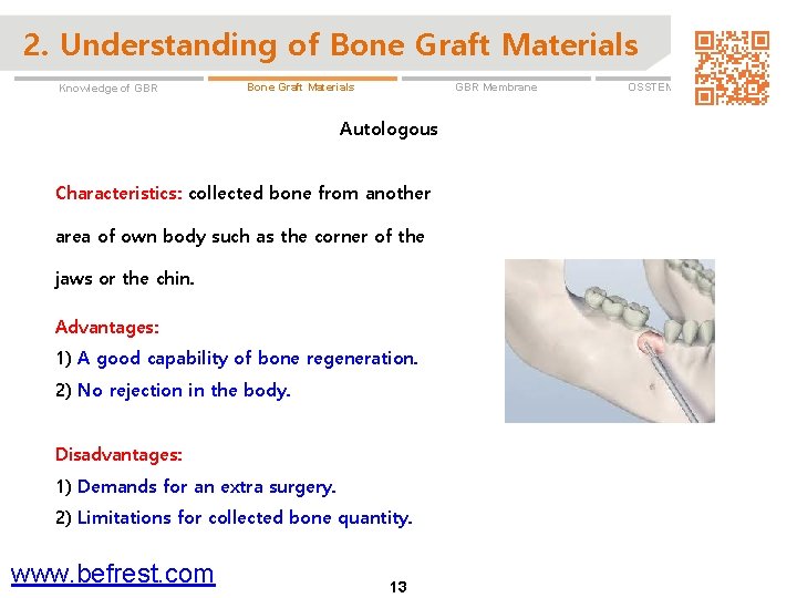 2. Understanding of Bone Graft Materials Knowledge of GBR Membrane Bone Graft Materials Autologous