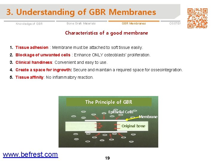 3. Understanding of GBR Membranes Knowledge of GBR Membranes Bone Graft Materials OSSTEM GBR