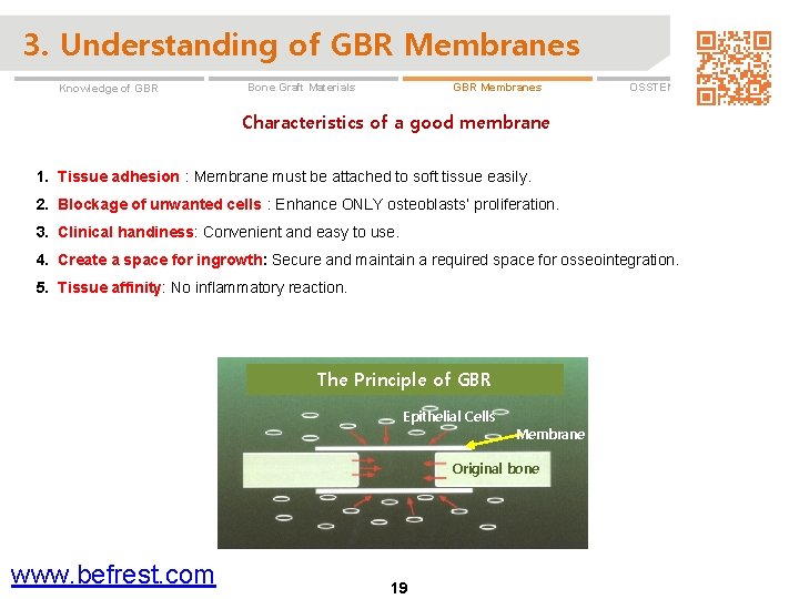 3. Understanding of GBR Membranes Knowledge of GBR Membranes Bone Graft Materials OSSTEM GBR