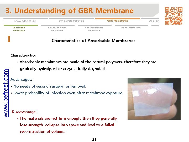 3. Understanding of GBR Membrane Knowledge of GBR Absorbable Membrane I GBR Membranes Bone