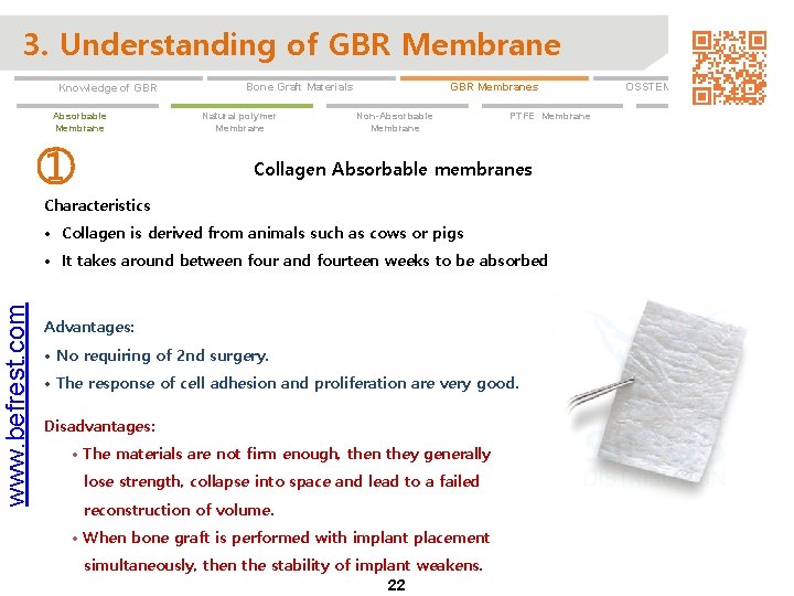 3. Understanding of GBR Membrane Knowledge of GBR Absorbable Membrane ① GBR Membranes Bone