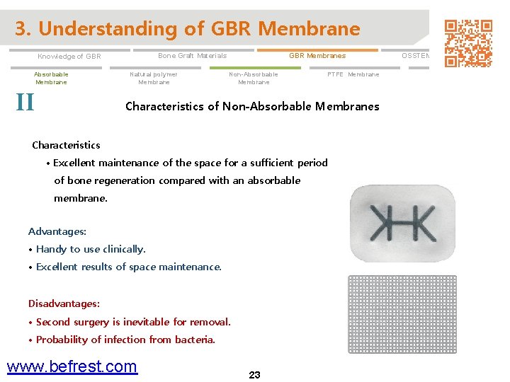 3. Understanding of GBR Membrane Absorbable Membrane II GBR Membranes Bone Graft Materials Knowledge