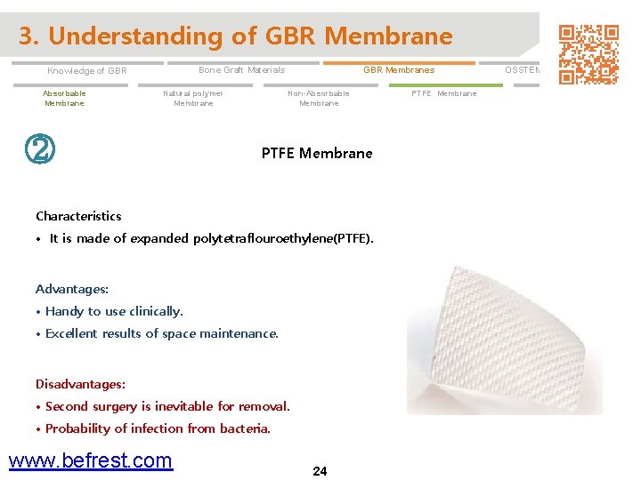 3. Understanding of GBR Membrane Absorbable Membrane GBR Membranes Bone Graft Materials Knowledge of