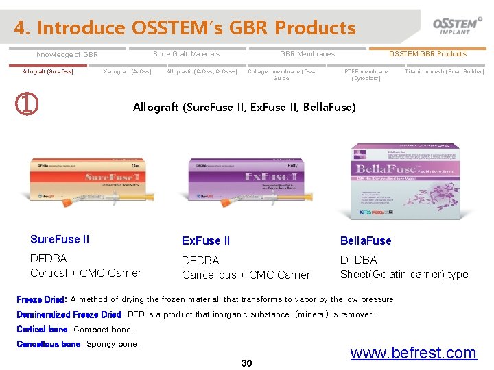 4. Introduce OSSTEM’s GBR Products Allograft (Sure. Oss) ① Xenograft (A-Oss) Alloplastic(Q-Oss, Q-Oss+) OSSTEM