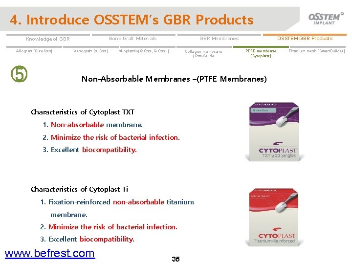 4. Introduce OSSTEM’s GBR Products Allograft (Sure. Oss) ⑤ Xenograft (A-Oss) OSSTEM GBR Products
