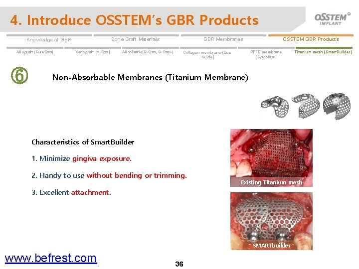 4. Introduce OSSTEM’s GBR Products Allograft (Sure. Oss) ⑥ Xenograft (A-Oss) Alloplastic(Q-Oss, Q-Oss+) OSSTEM