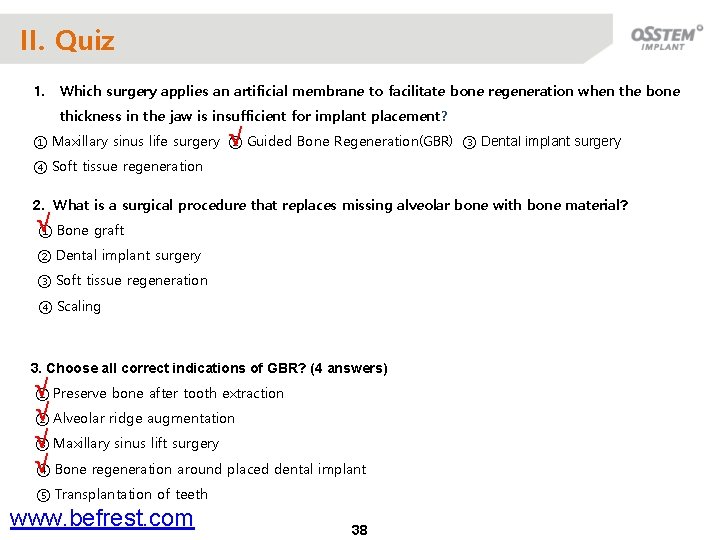 II. Quiz 1. Which surgery applies an artificial membrane to facilitate bone regeneration when