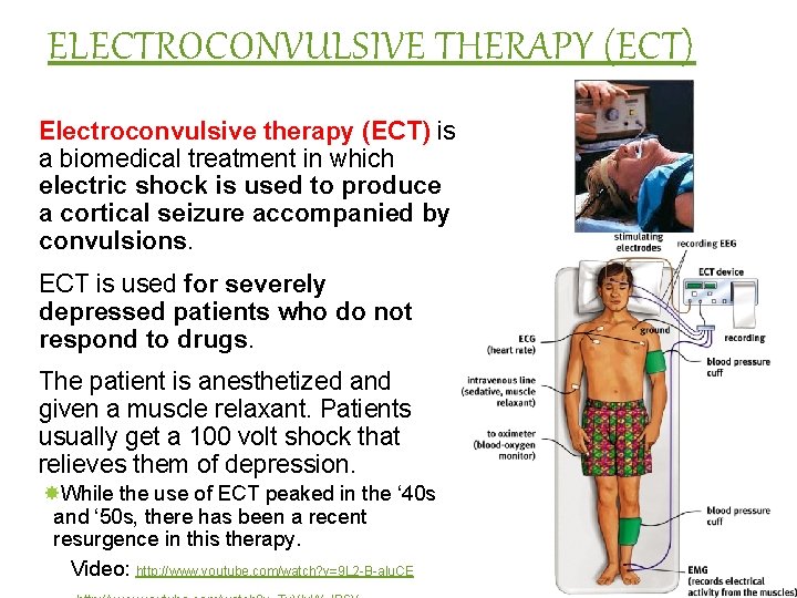 ELECTROCONVULSIVE THERAPY (ECT) Electroconvulsive therapy (ECT) is a biomedical treatment in which electric shock