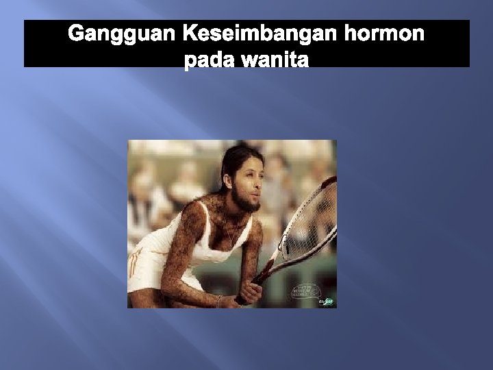 Gangguan Keseimbangan hormon pada wanita 