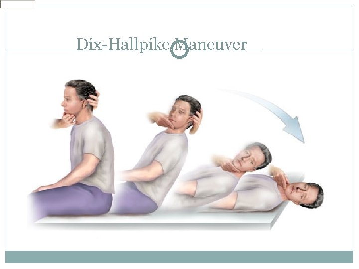 Dix-Hallpike Maneuver 