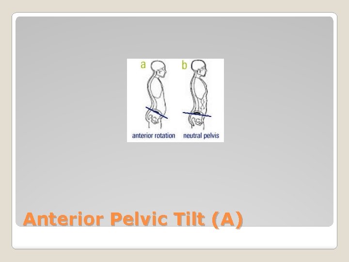 Anterior Pelvic Tilt (A) 