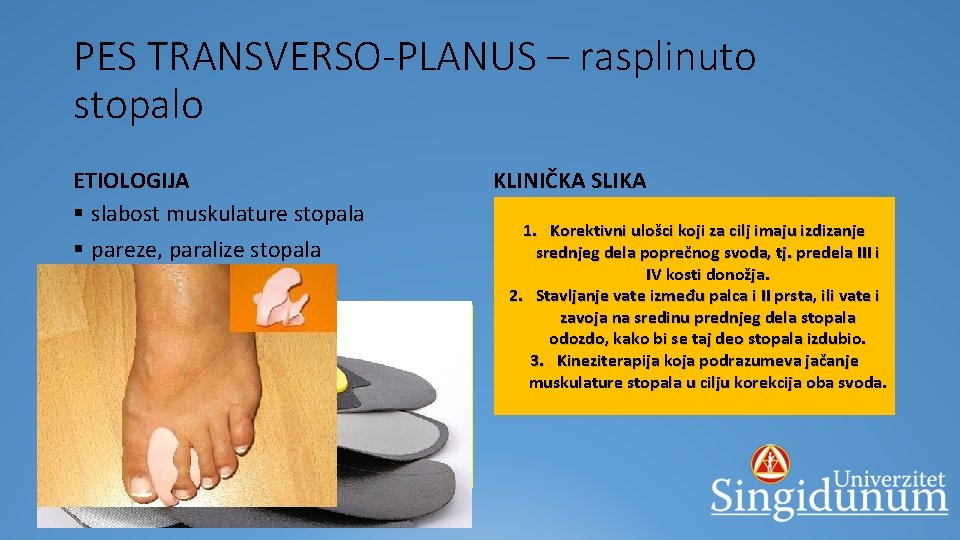 PES TRANSVERSO-PLANUS – rasplinuto stopalo ETIOLOGIJA § slabost muskulature stopala § pareze, paralize stopala