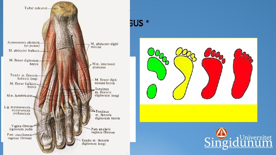 PES PLANUS i PES PLANOVALGUS * § popuštanje mišića prednje strane potkolenice, uz prevagu