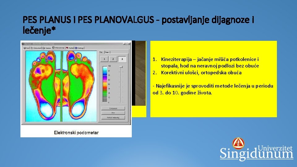 PES PLANUS i PES PLANOVALGUS - postavljanje dijagnoze i lečenje* 1. 2. 3. 4.