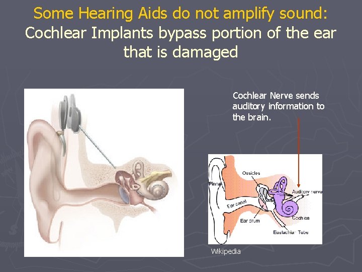 Some Hearing Aids do not amplify sound: Cochlear Implants bypass portion of the ear