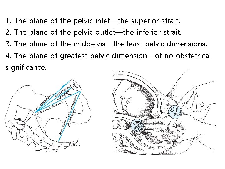 1. The plane of the pelvic inlet—the superior strait. 2. The plane of the