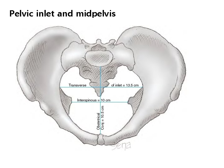Pelvic inlet and midpelvis 