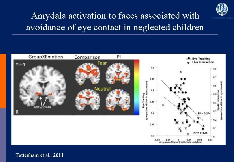 Amydala activation to faces associated with avoidance of eye contact in neglected children Tottenham