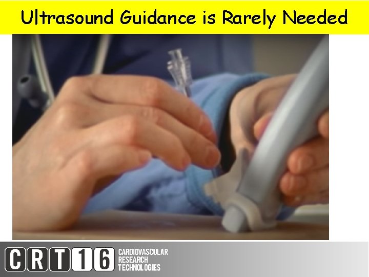Ultrasound Guidance is Rarely Needed 