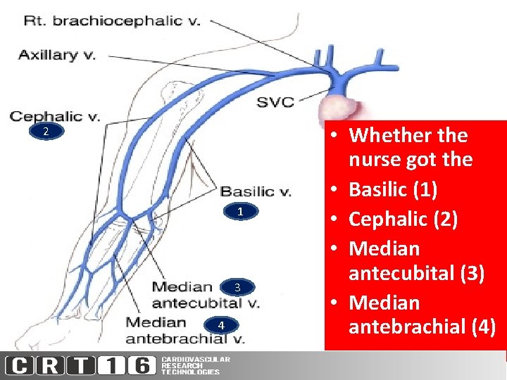 2 1 3 4 • Whether the nurse got the • Basilic (1) •