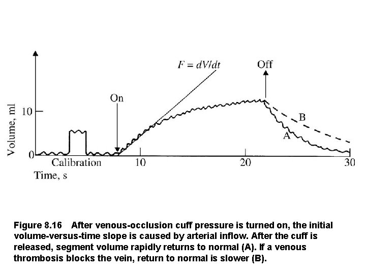 Figure 8. 16 After venous occlusion cuff pressure is turned on, the initial volume