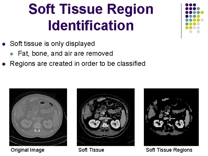 Soft Tissue Region Identification l l Soft tissue is only displayed l Fat, bone,