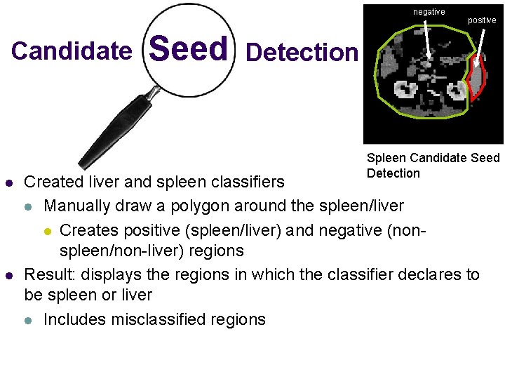 negative Candidate l l Seed positive Detection Spleen Candidate Seed Detection Created liver and