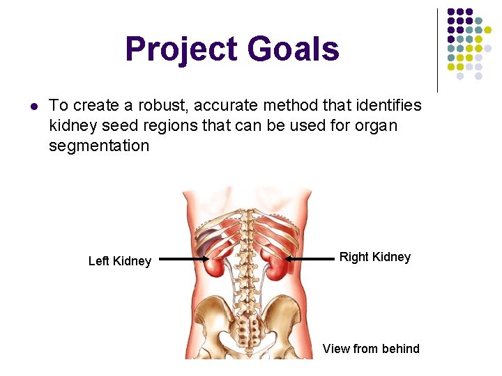 Project Goals l To create a robust, accurate method that identifies kidney seed regions